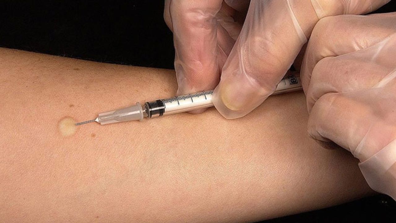 Eskişehir'de kuduz uyarısı: Düzenli aşı...