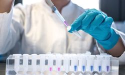 Dünya AIDS Günü’nde uyarı: HIV ile yaşayanların sayısı artıyor