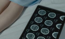 Baş ağrısı ve kusma beyin tümörünün ilk sinyali olabilir