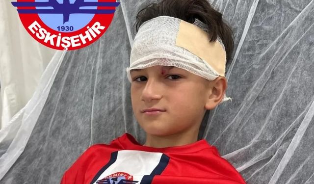 Küçük futbolcu korkuttu
