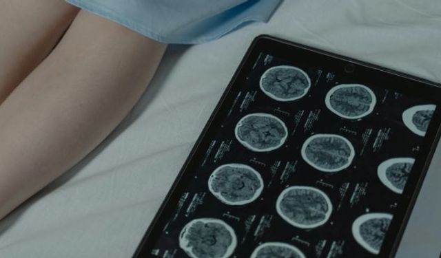 Baş ağrısı ve kusma beyin tümörünün ilk sinyali olabilir