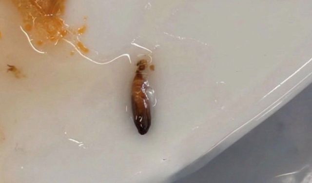 Anadolu Üniversitesi’nde kurtlu öğrenci yemeği krizi!