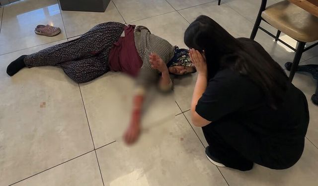 Afyon'da dehşet anları: Köpek kadının kolunu kopardı